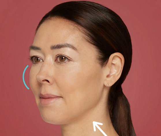 After Treatment